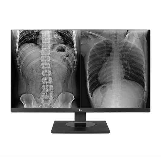 LG 27inch 27HJ713C UHD IPS LED Clinical Monitor - 3840x2160 (16:9) / 5ms / 60Hz / VESA  - 27HJ713C-B